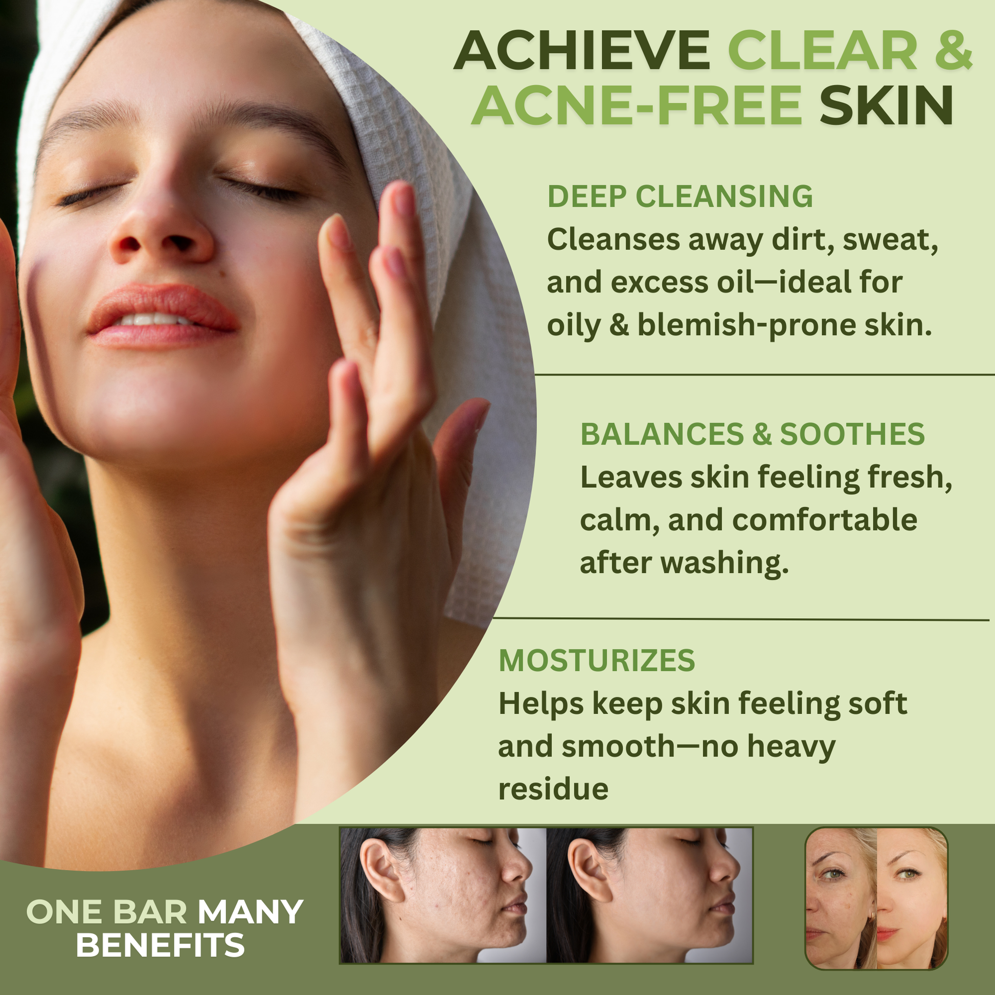 Skincare soap highlighting cleansing and balancing benefits for oily and blemish-prone skin
